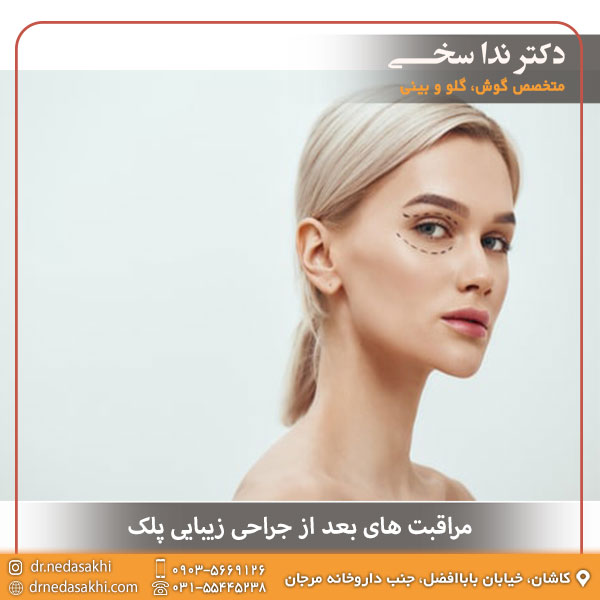 مراقبت های بعد از جراحی زیبایی پلک