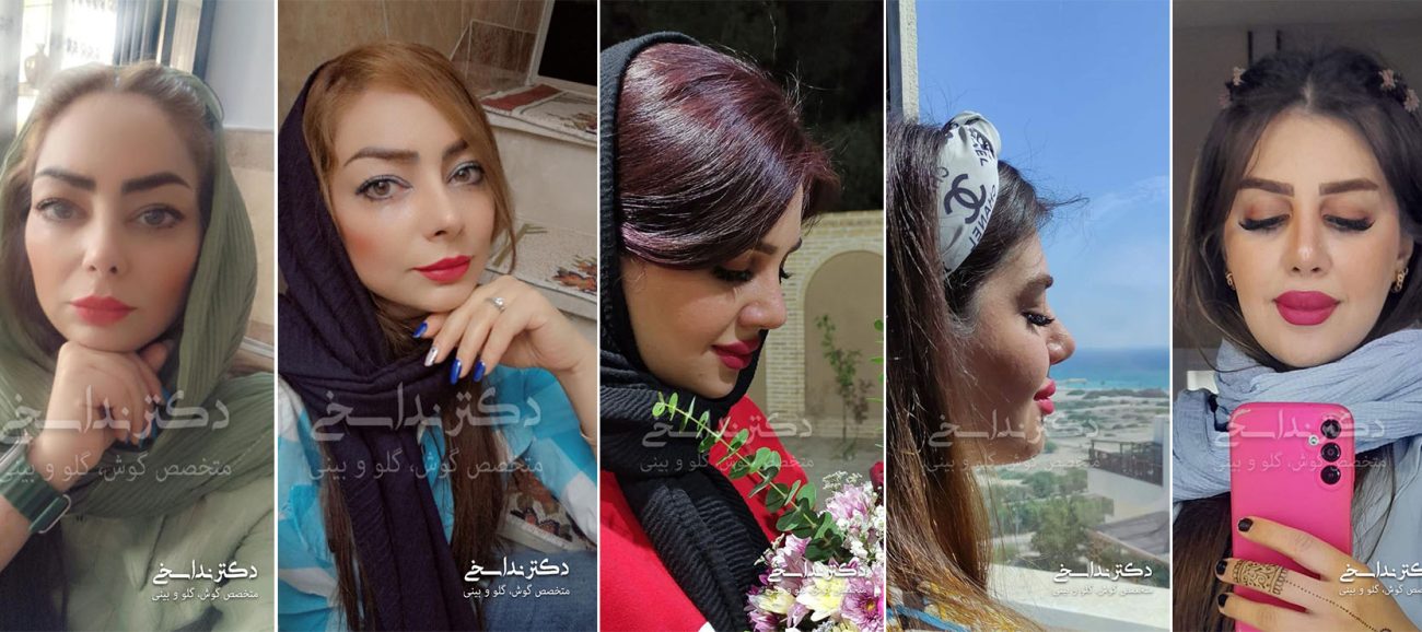 جراحی بینی فانتزی