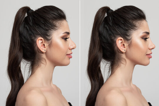 جدیدترین روش عمل بینی