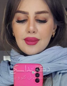 چند ماه بعد از عمل بینی