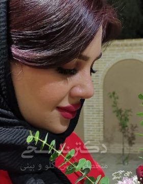 چند ماه پس از جراحی بینی