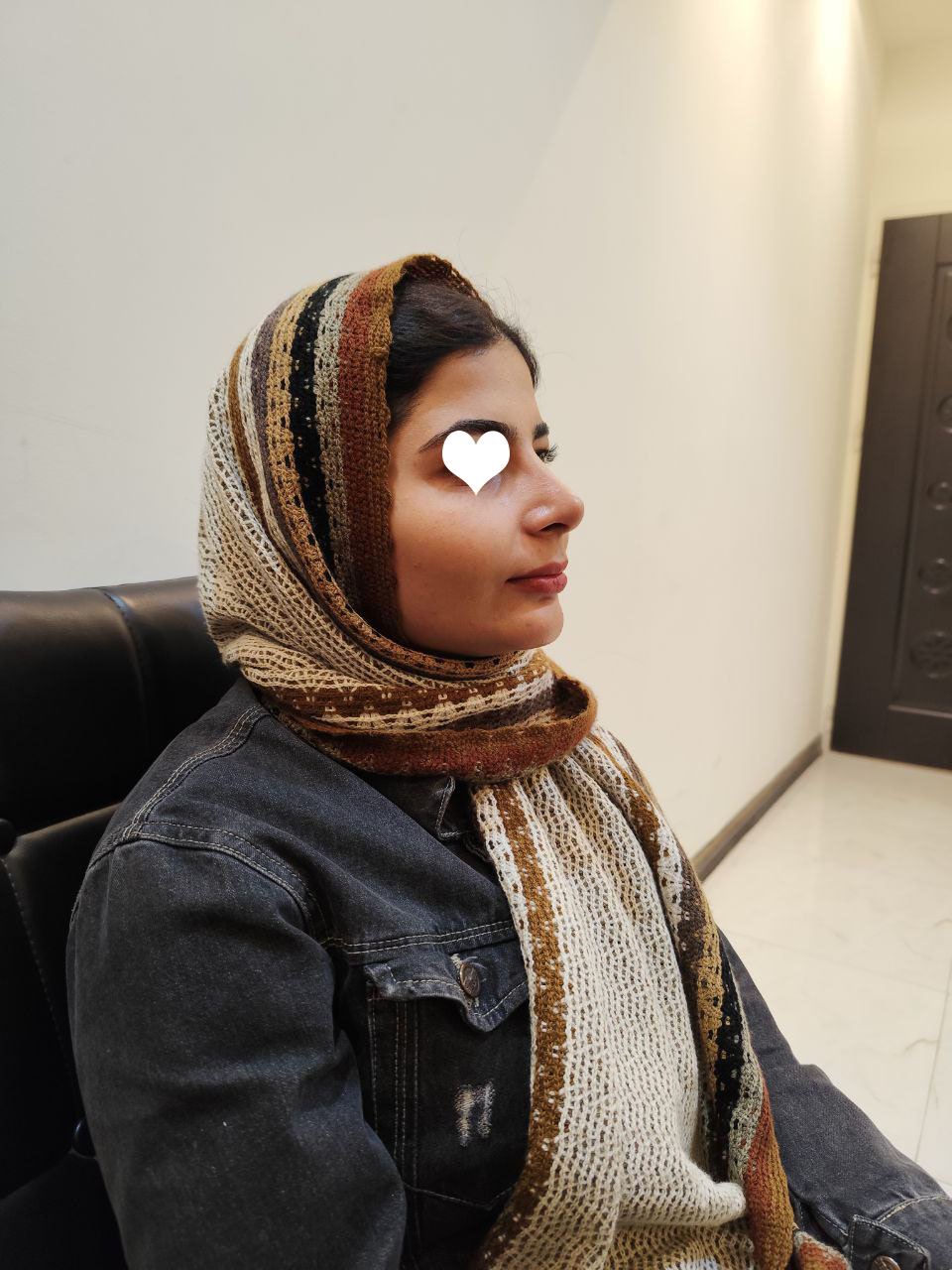 عمل زیبایی بینی