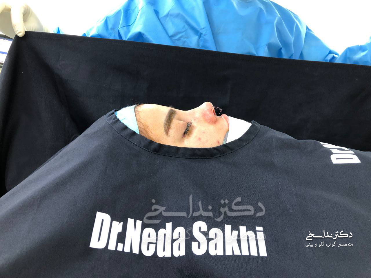 جراحی بینی نچرال