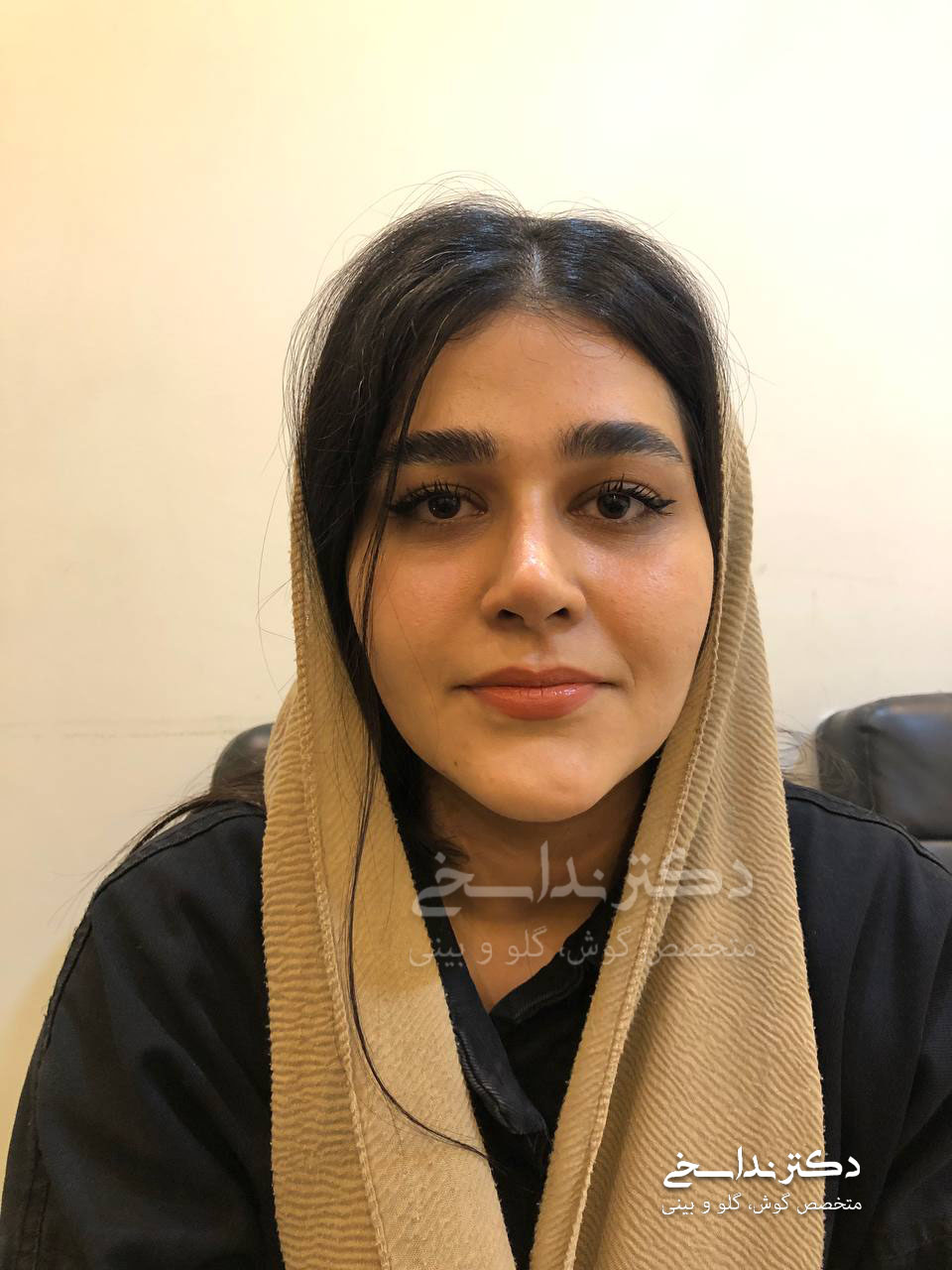 عمل بینی