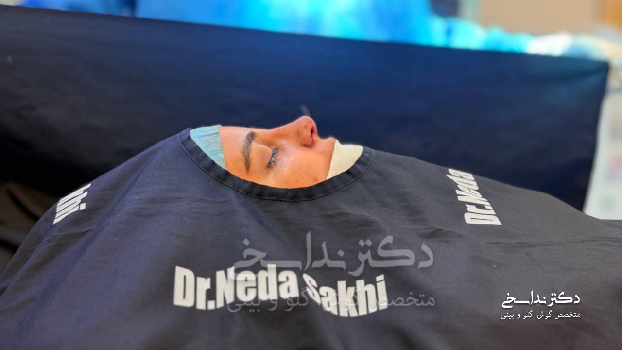 انحراف بینی