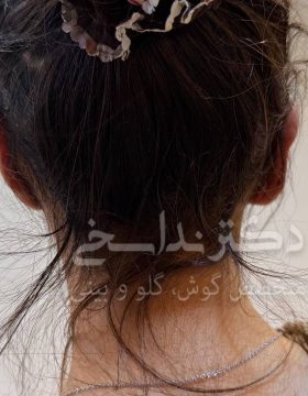 جراحی گوش