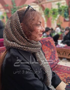 چند ماه پس از جراحی بینی