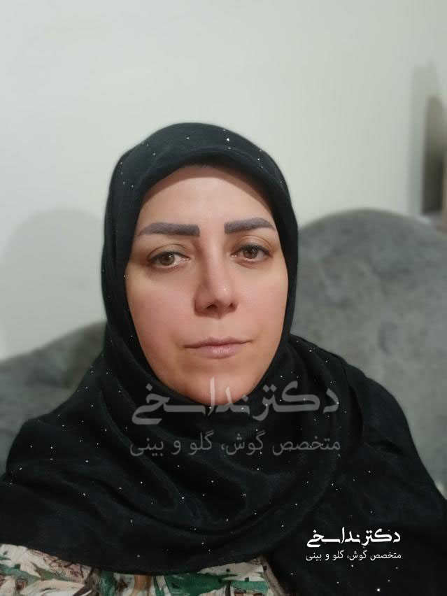 فرم بینی نچرال