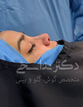 عمل بینی کاشان