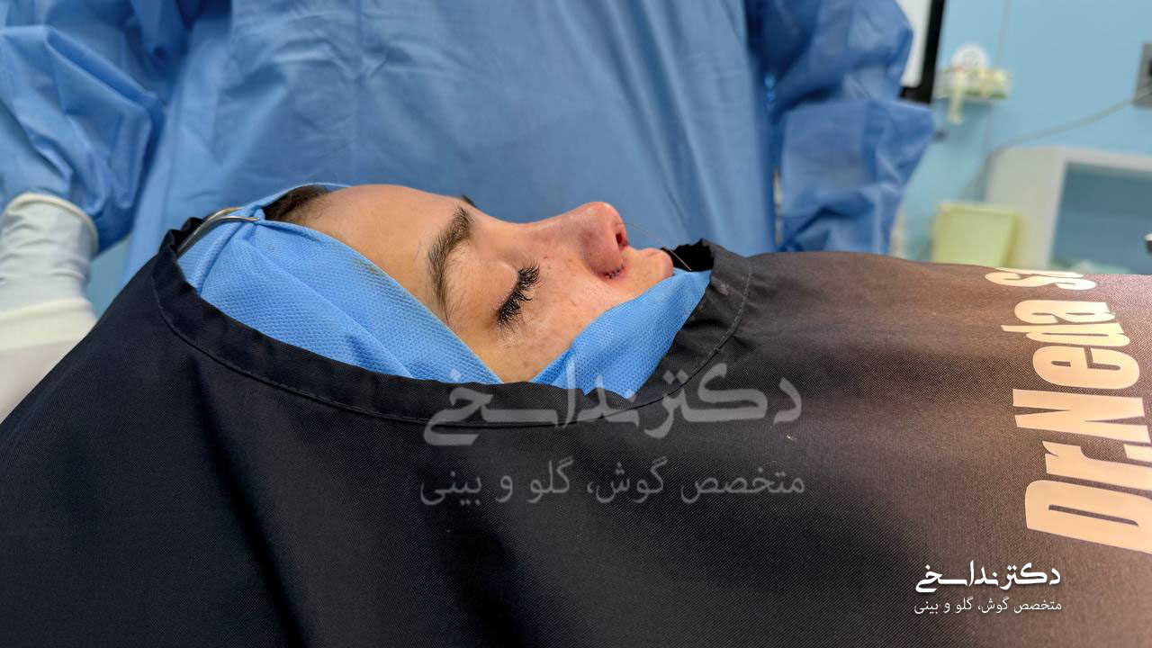 بلافاصله پس از جراحی بینی