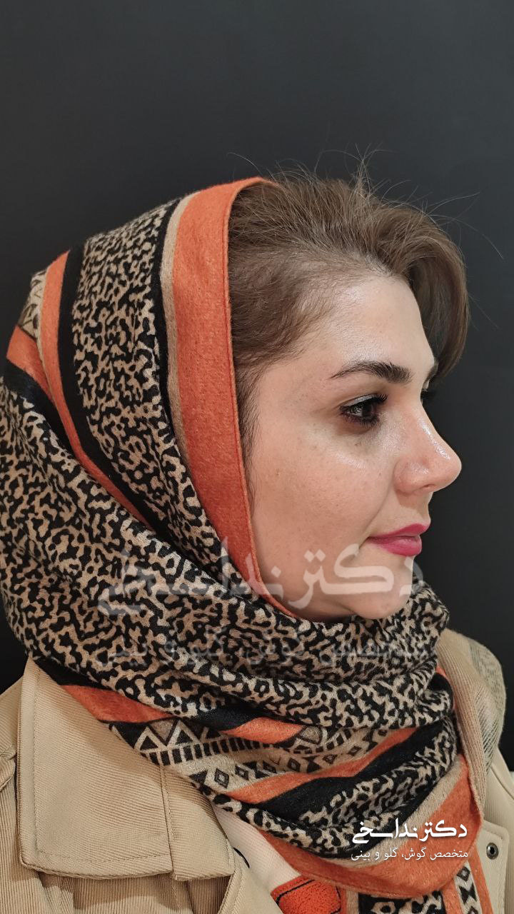 عمل بینی