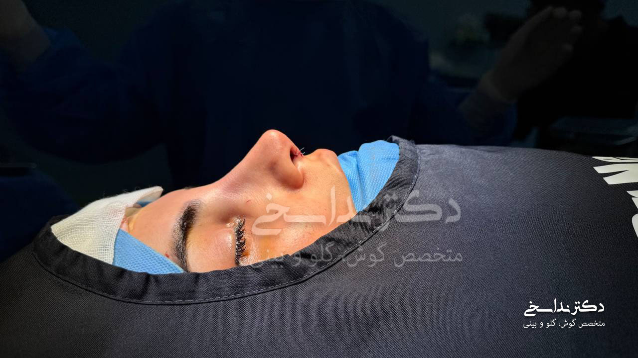 بلافاصله بعد از عمل