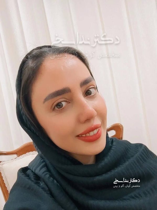 چند ماه بعد از عمل بینی
