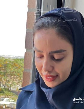 چند ماه پس از عمل بینی