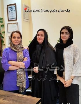یک سال و نیم بعد از عمل
