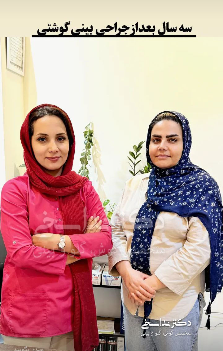 سه سال پس از جراحی بینی گوشتی