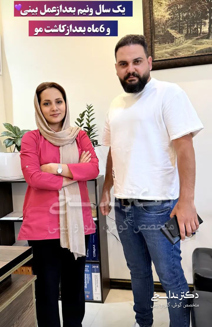 چند ماه پس از عمل بینی