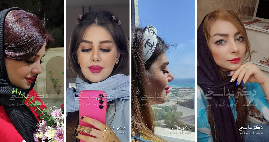 کدام فرم بینی در عکس خوب است