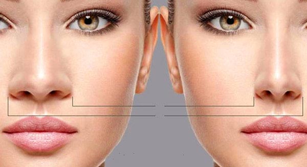 3 اشتباه رایج که نباید قبل از عمل بینی مرتکب شوید!